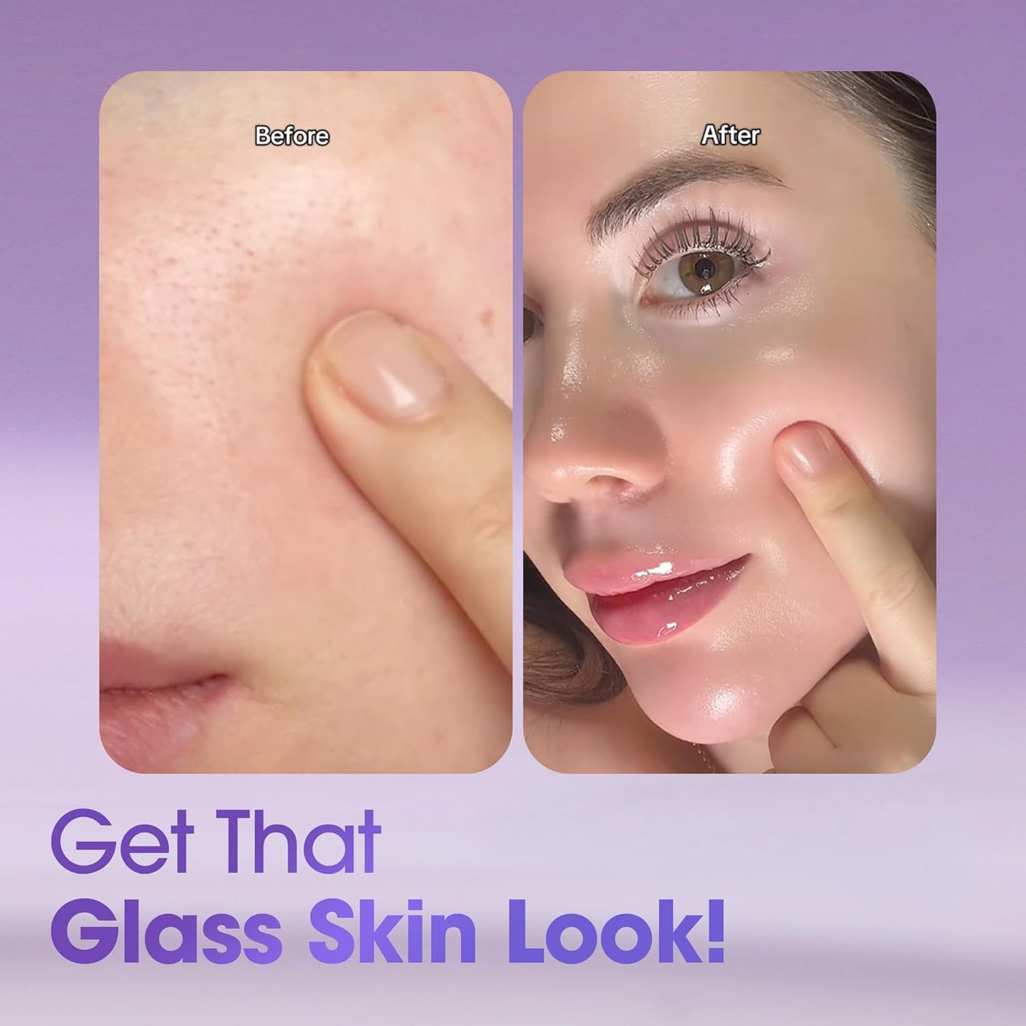 Some By Mi Retinol Intense Reactivating Face Serum | 30ml | Mild 0.1% Retinol Serum For Anti-Aging And Glass Skin | Improvement Of Post Acne Marks, Skin Texture & Elasticity