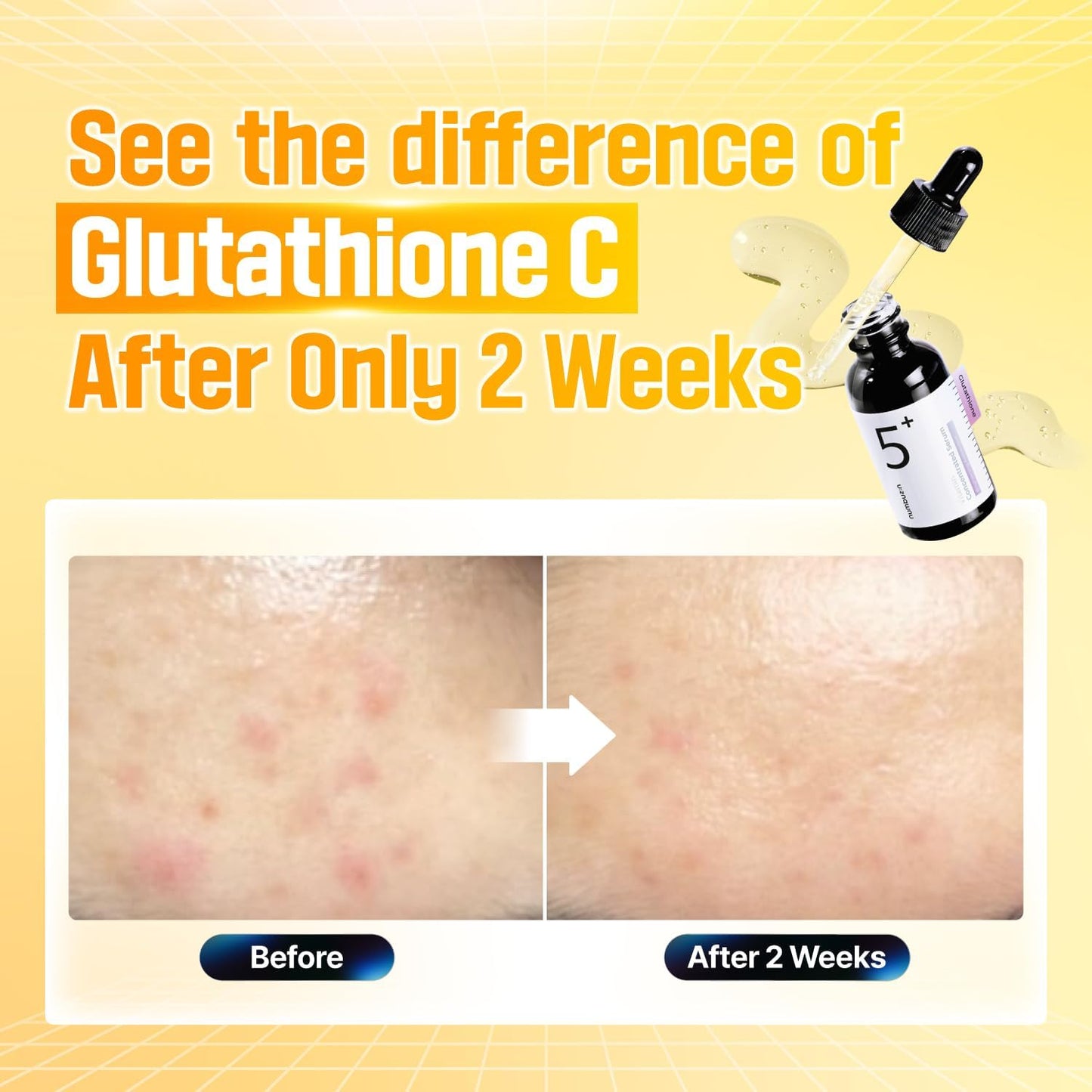 numbuzin No.5 Vitamin Concentrated Serum | Glutathione & Vitamin Serum, Dark Spot.01fl.oz/30ml