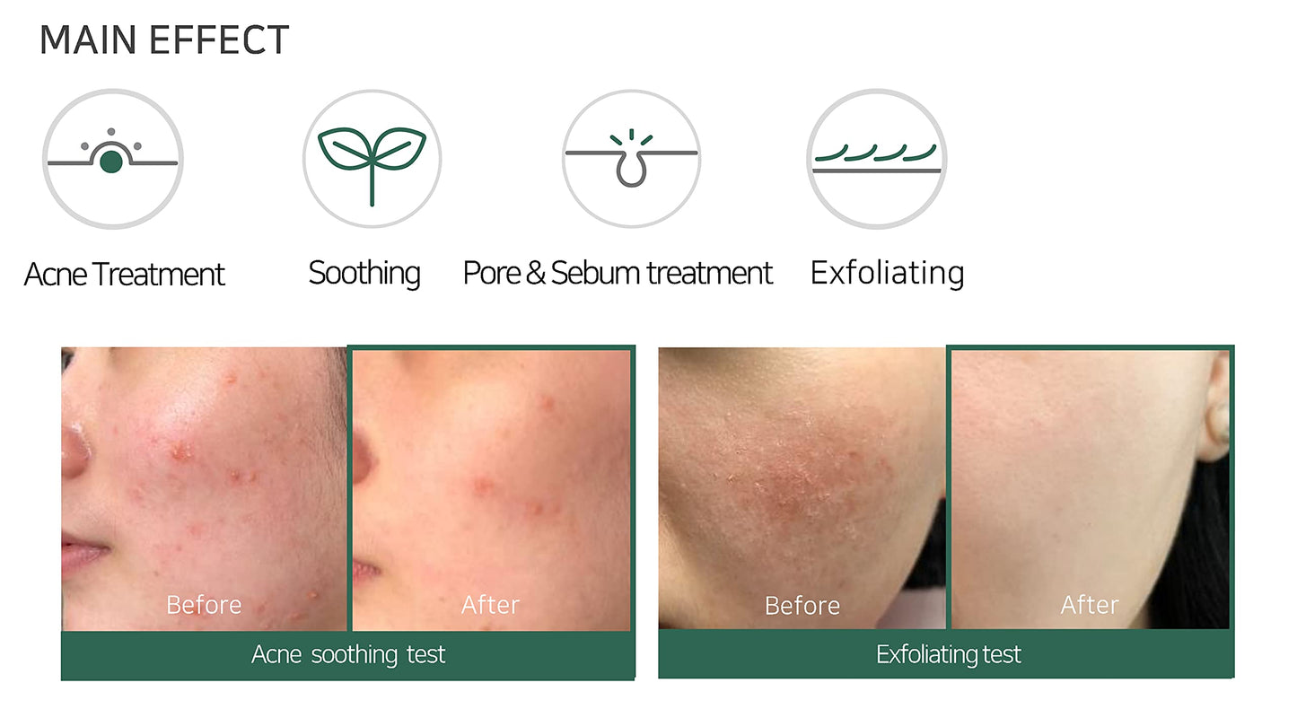 SOME BY MI "" AHA.BHA.PHA 30 Days Miracle Acne Clear Foam (100 ml)