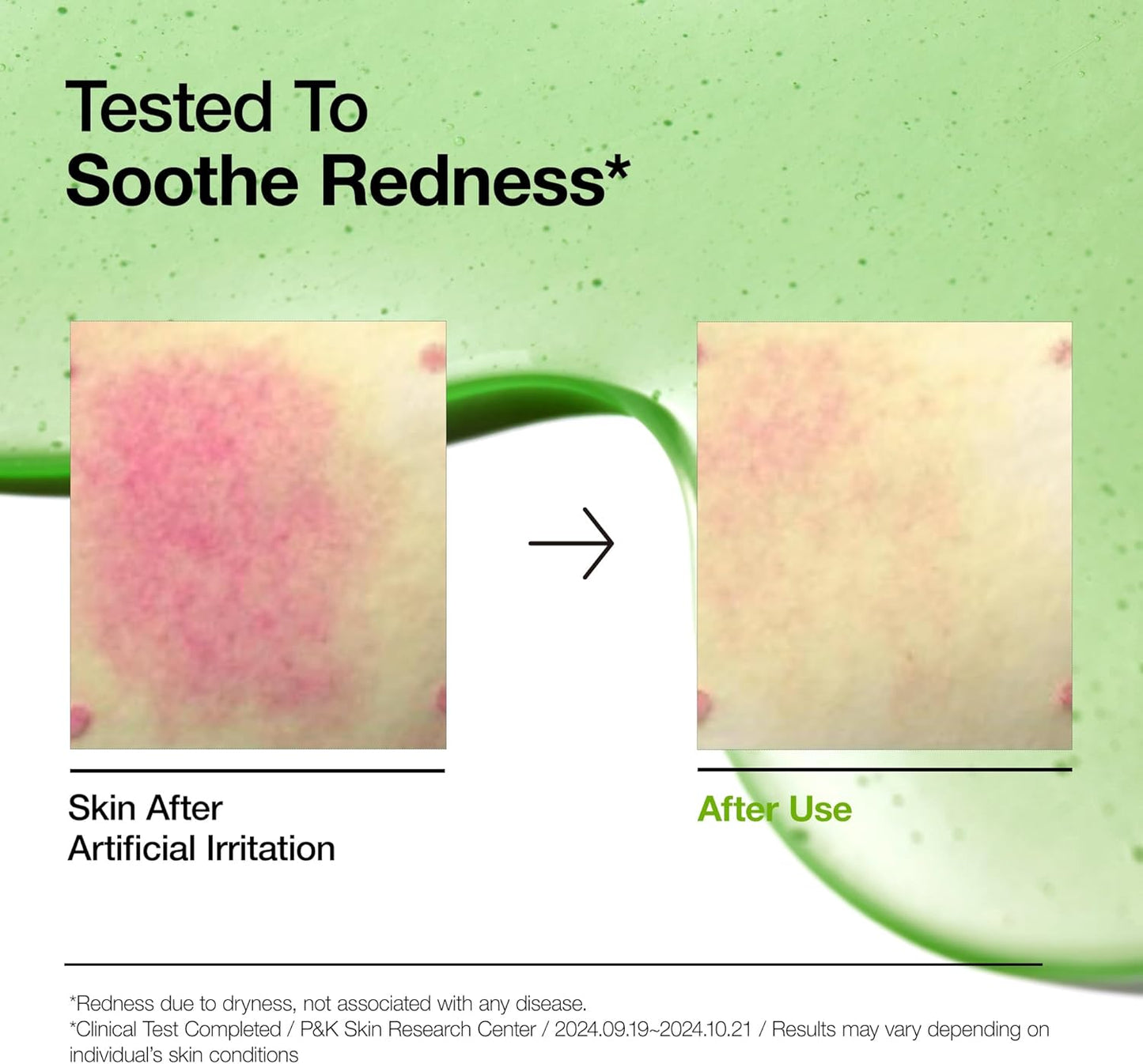 Azelaic Acid 10 Hyaluron Redness Soothing Serum 30ML